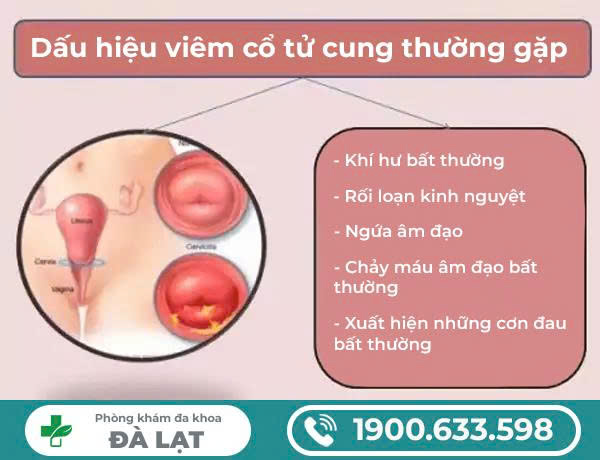 Hình ảnh minh họa